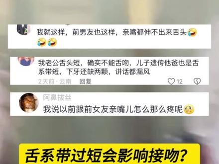 舌系带太短 会影响接吻?众多网友现身说法!