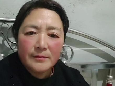 上个视频有的问我是因为什么打的 问我是怎么回事 我今天都跟你们说说