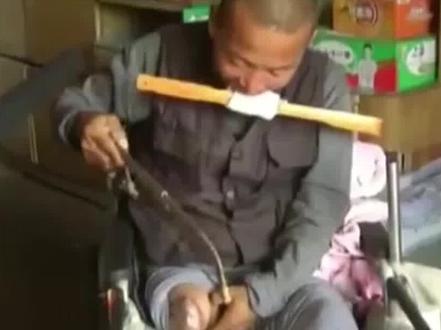 河北硬汉郑艳良,为省下百万手术费,自己用钢锯锯断右腿求生