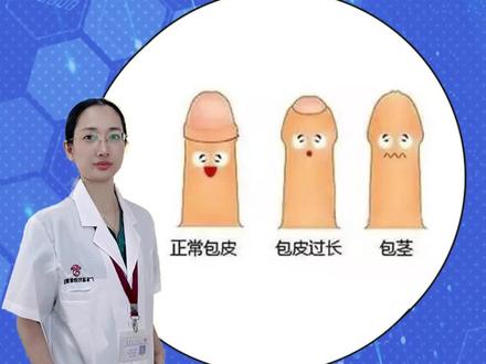 解答关于小孩子割包皮的一些问题01