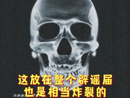 #粉丝晒木子洋头骨图辟谣整容 木子洋的回应真的是好笑加倍了#oner #木子洋 #粉丝 #搞笑 @抖音小助手 @DOU+小助手