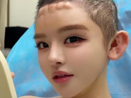 原来我离顶美就差一个额结节!#额结节 #顶美 #变美逆袭 #捏脸