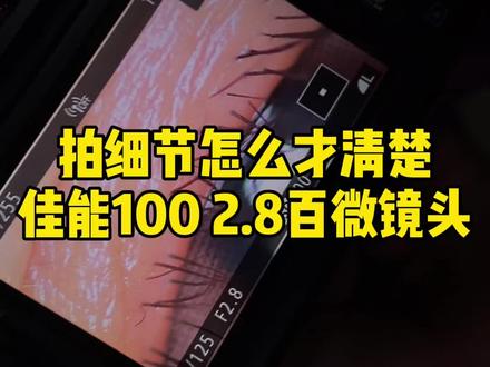 拍细节怎么拍清楚,佳能100 2.8二代百微镜头很香了#牙齿摄影 #微距摄影 #佳能相机 #佳能镜头 #摄影师日常