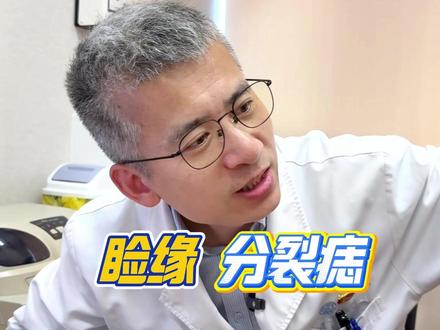 小伙睑缘分裂痣 #睑缘分裂痣 #黑色素痣 #黑色素瘤 #疤痕专家吕开阳 #了不起的医生