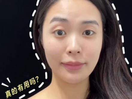 第一次打斜方肌,不知道有没有用😂 #斜方肌 #瘦肩 #瘦肩针