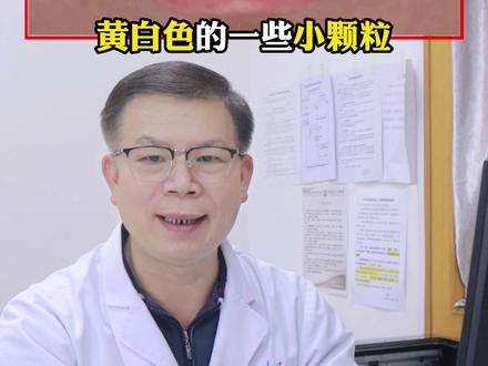 嘴唇上长小白点,别再用白醋去擦了!#科普 #涨知识