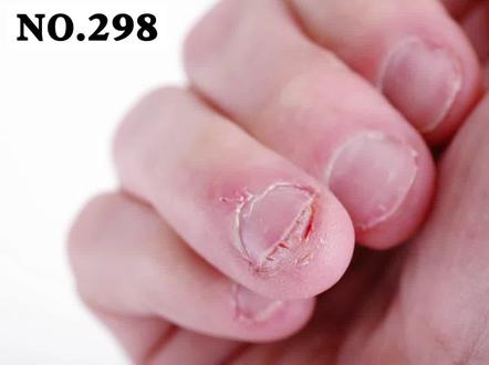 喜欢咬指甲往往和焦虑、自卑有关,一定要及时看心理医生。#医学科普 #科普 #咬指甲