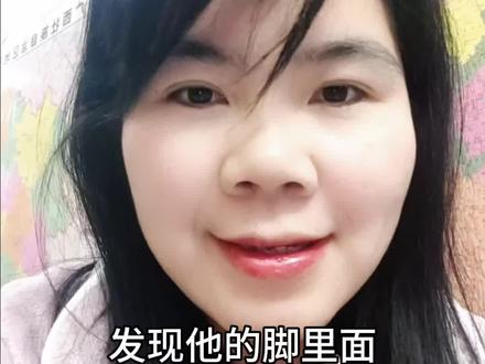 孩子脚底扎进无头木刺,2个办法可以让木刺自动跑阳来#安全 #安全教育#急救科普