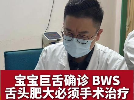 宝宝巨舌确诊BWS,舌头肥大必须手术治疗 #bws #巨舌 #育儿