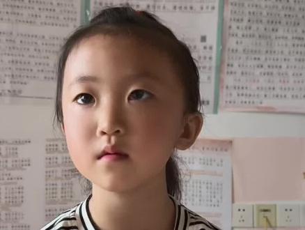 两条腿磕的青一块紫一块的#记录孩子真实成长日常 #我的小话唠