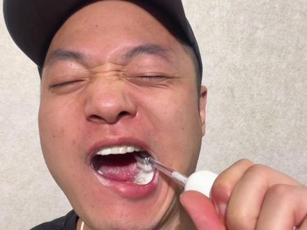 慎重考虑电动牙刷!不是所有人都需要电动牙刷!