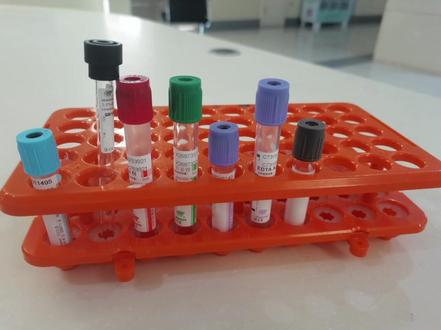 😀如采用直针真空采血时,先抽需氧瓶(蓝色),后抽厌氧瓶(紫色)
😀如采用蝶翼针采集时,先抽需氧瓶(蓝色),后抽厌氧瓶(紫色),因为此时蝶翼针连接管中的空气被引入需氧瓶,所以先抽需氧瓶。
😀注射器采血时,注射器中的血液注入血培养瓶,由于空气轻,气泡会上升,此时注射器上部的血液中存在气体的可能性大,应避免将其中的氧气引入厌氧瓶。总之,无论采用何种采血方式,应最大限度的避免空气进入厌氧瓶。
😀静脉采血时,采血管的顺序为蓝,黑,黄,红,绿,紫,灰
##护理实习 #护理小白#护理学妹