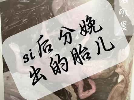 《尸变图鉴》系列 案例3 #法医 #读书 #尸变图鉴 #科普 #医学