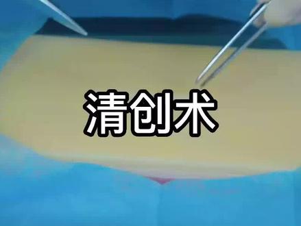临床实践技能基本操作:清创术 #医考 #助理医师考试 #执业医师考试 #实践技能考试 #有猿医学