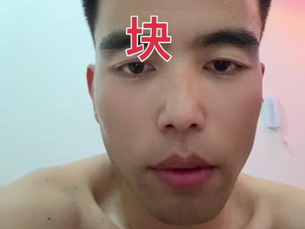 #医院 做个包皮手术需要多少钱