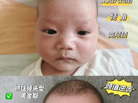 15天逆袭小圆头,我做对了什么?
头型决定颜值,很多妈妈对宝宝的头型很焦虑,甚至愿意花大几千给宝宝矫正头型,作为一个给宝宝睡小圆头成功上岸的妈妈告诉你,宝宝睡圆头真的没有那么难
首先一定要清楚,宝宝具体的头型问题,才能更精准帮助宝宝调整头型
常见头型问题有偏头、扁头、舟状头、菱形舟状头、太阳穴凹陷、犄角
详细操作步骤分享给大家,简单易上手
其次抓住睡头型黄金期,越早改善越早调整
0-3月是宝宝睡头型黄金期
3-6月是头型调整期
6-12月是头型保持期
最后睡头型是一个循序渐进的过程,千万不能三天打鱼两天筛网,所以妈妈们一定要坚持哦,每一位宝宝都能收获漂亮小圆头
#睡圆头 #如何睡圆头 #育儿经验分享 #圆头 #宝宝睡圆头