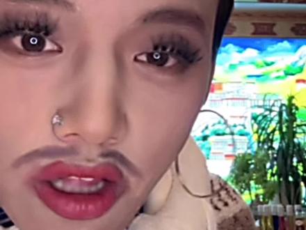 大大怪下巴脱臼后续#孟令辉#大大怪