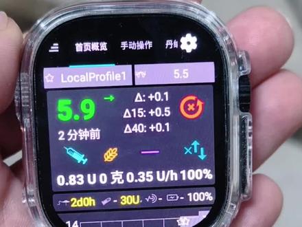 1型糖经验分享71|丹纳rs使用小技巧分享
#1型糖尿病 #1型糖宝 #丹纳rs #胰岛素泵