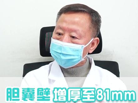 胆囊壁增厚至81mm,必须切除!#健康 #医学科普 #山西太原 @抖音小助手