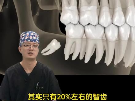 这些智齿的秘密,你都知道吗? #牙齿 #智齿 #抖出健康知识宝藏 #我的年度健康盘点