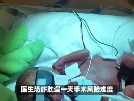 转发重录:小洛熙妈妈讲述被医生劝做微创手术过程 #我为小洛熙发声 转发重录:#小洛熙妈妈讲述被医生劝做微创手术过程 #医疗纠纷 #小洛熙妈妈 #医疗纠纷律师
大家晚上好,这几天网上有个质疑,为什么当天决定给小洛西做这个手术。我复盘总结了一下,给大家解答我女儿因为早产儿每月会定期去某妇某头颅医院挂早产高医生号,做定期成长监测。在医生建议下,常规做了脑部ct,心脏彩超听力迟试。
十一月十一号做心脏彩超过程中发现彩超是有疑问,单子出来后,建议我们挂心外科医生咨询,我们随即挂了当天小儿心外科主任医师陈某贤。他看了报告单,说房间隔缺损,这个情况要立刻手术。我随即提出质疑,听说很多早产宝宝一岁后会自己闭合,我们是否可以再等等观察看看。
他说,房间隔缺损三毫米和七毫米,自愈概率很低,耽误一天就引起手术难度,风险增高,并恐吓我们后不做,就会引起后面吃奶困难发育迟缓影响智力等。并且说只是腋下微创及低增高手术时长啊,两个半小时到三小时,一次性处理闭合不会再复发。
每一年做两百台技术很成熟,是心脏科较简单的微创,成功率百分之九十九。那一台也只是手术没那么顺利。为了确保百分之百安全,有条件的话,加一台心脏起搏器,难道你们运气那么差吗?说后我们同意一家起搏器,以防万一全程陈主任谈话沟通非常的亲民和自信有耐心,而且没有任何提醒我们,再等一等看一看,只是一直说我们女儿符合当下即科手术的指标。
鉴于对某妇某同在当地权威儿童医院的身份,陈某贤又是主任医师这两个身份标签的双重信任。我们当天决定听医生的话,接受了办理住院,只合各种抽血检查,但我还是不太放心。让婆婆看护着小洛溪两夫妻下午又去了当地某三甲医院服务台咨询心脏科婴儿挂号,心想换个地方,听听别的医生建议。
工作人员说,你这小孩才五个多月,越大太小了,我院都是做成人心脏科手术多,你们还是去某妇女院?就是当时我女儿住的医院,我当时就增加了放心度,返回去了。秉着不要质疑专家技术,选择了,就相信医生那么有耐心。
而且说了微创小切口小手术,毕竟医生说了要及时做,在当下的城市,也没有更多的咨询空间了。最终结局女儿当天离世,新生儿和早产儿的父母都懂,恨不得把医生的话当圣旨那种很爱很爱很紧张。小孩,可惜小洛洛没有遇到好的医生,该反思的除了我们父母对医生的严谨严严纪,听从是不是还存在过度医疗和更多信息隐瞒呢?
我相信在我合理维权的路上,总有一天会有真相。