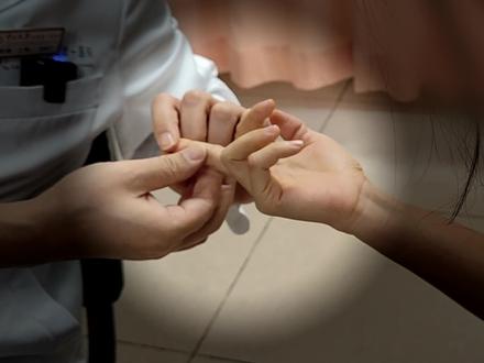 女子手指疑似生长腱鞘巨细胞瘤,太小做不了活检,建议做磁共振看看到底是腱鞘囊肿还是腱鞘巨细胞瘤,再做下一步打算。#腱鞘囊肿 #腱鞘巨细胞瘤 #骨肿瘤 #门诊日常 #骨肿瘤科尹军强