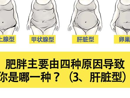 减肥前要知道的肥胖类型|肝脏型
肝脏型肥胖
特征:这类肥胖腹部凸起明显(俗称啤酒肚)
表现:突出较严重的大肚子
#健康#减肥#瘦身#减重#健康瘦
