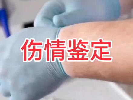 伤情鉴定的那些事#冷知识 #法律科普 #伤情鉴定
