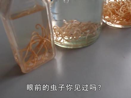 几十年前,几乎人人肚里都有蛔虫,为啥现在消失不见了? #蛔虫 #科普