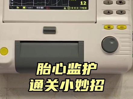 胎心监护是孕晚期一项很重要的检查,可是老是不通过怎么办呢?试试这几招#孕期 #产检