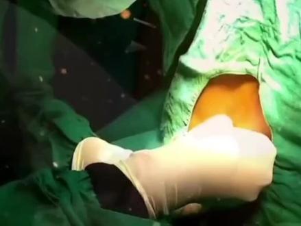 女人们这个针不陌生吧,全长 8八厘米,有八小格,从腰部脊椎注入体内,站久了腰疼,坐久了腰会酸疼,躺久了腰也会疼。#麻醉的后遗症 ##愿所有女孩都能被温柔对待