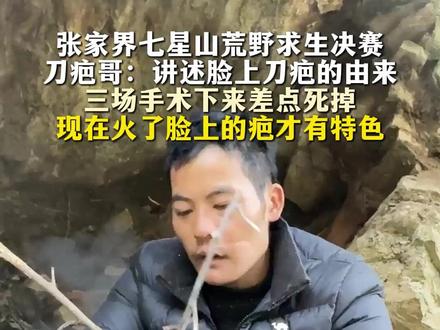 12月1日|张家界 张家界七星山荒野求生决赛 刀疤哥:讲述脸上刀疤的由来 三场手术下来差点死掉 现在火了脸上的疤才有特色#荒野求生