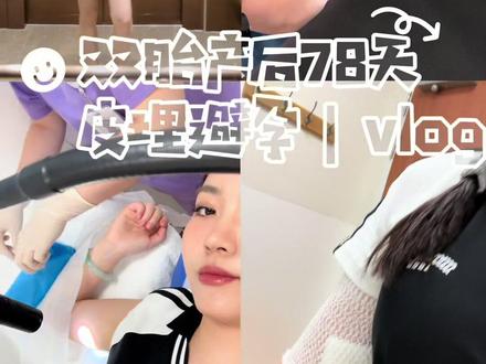 产后78天皮埋避孕全过程分享#皮埋避孕 #一切都在慢慢变好
