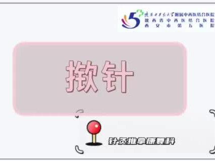 针灸治疗新选择,安全又无痛