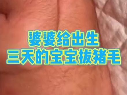 孩子身上长猪毛?到底是怎么回事?#育儿 #毳毛 #科普 #南方健康