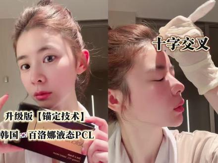 春天孩子们补钙,妈妈们捏脸开始。🇰🇷韩国液态PCL保姆级教程一次成本💰200,跨脸姐妹想提升的居家操作起来。#真实分享 #少女针轮廓固定 #百洛娜液体线雕 #居家水光