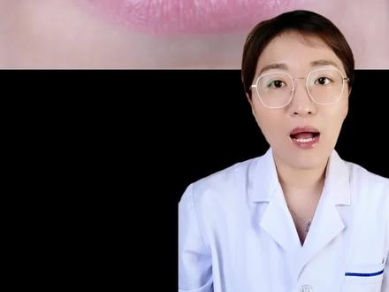 不是所有孩子都这么幸运,能补救的我们要积极采取措施##口腔健康 #育儿 #门牙 #孩子 #父母必看系列 #补牙 #口腔科普