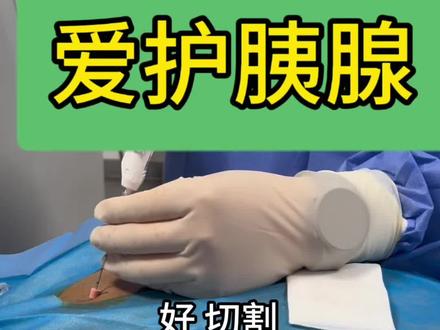 胰腺肿瘤穿刺活检#医学科普 #胰腺癌 #穿刺活检