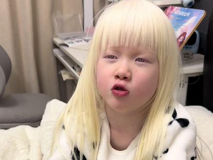 女儿问我为什么只有她是白色 无论是黑发的你还是白发的你,在妈妈眼里你永远是最美最棒的~虽然缺少了黑色,但白色也可以很美,很耀眼~#白化病女孩 #月亮的孩子 #小爱莎