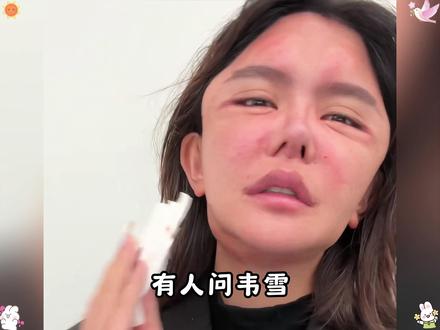 有人问韦雪,如何看待韩安冉因为过度整容,导致呼吸不畅,韦雪一番高情商回复,瞬间点醒无数好友......##韦雪 ##眼膜 ##爆款 ##抗皱 ##变美