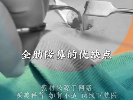 全肋隆鼻优缺点一次性讲清楚! #全肋隆鼻 #医疗健康创作训练营 #抖出健康知识宝藏 #健康科普不基础 #吴付习软糖鼻