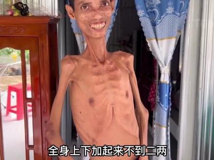 #颠覆三观 #真实事件 越南老表瘦成了一个杆#解说 @抖音小助手