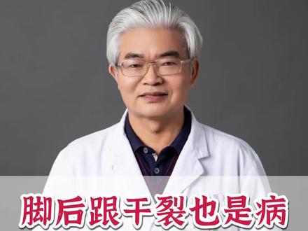 脚后跟干裂也是病,甚至会传染。 #抖出健康知识宝藏