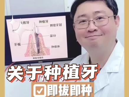 口腔教授|种植牙什么时间比较合适,有什么区别?#口腔健康 #医学科普 #一口好牙 #口腔 #医者仁心