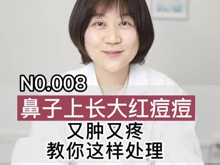 鼻子上长红色大痘痘,又肿又疼,原来可以这样处理 !!#痘痘 #医学科普 #皮肤 #健康