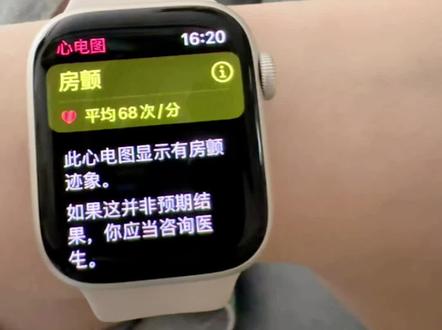 额..苹果的准嘛……#iwatch #科技改变生活