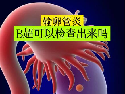 输卵管炎B超可以检查出来吗?