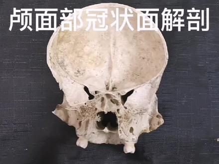 颅骨冠状面的后面观