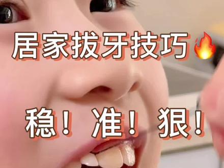 沉浸式拔乳牙!一根绳子稳准狠!一拔一个不吱声!娃不哭不闹,牙说掉就点!#拔乳牙小技巧 #猪鼻扣 #可爱的小萌娃 #创作者中心 #创作灵感