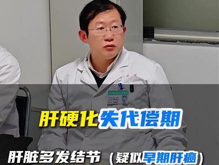 肝硬化失代偿期,肝结节疑似肝癌怎么处理?肝腹水,门静脉高压。#肝硬化失代偿期 #肝结节 #肝硬化 #肝癌 #医学科普